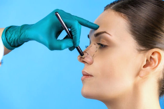 OPEN/STRUCTURAL RHINOPLASTY